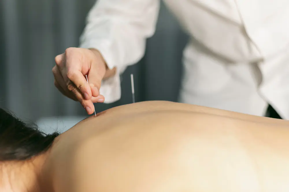 Acupuncture Therapy